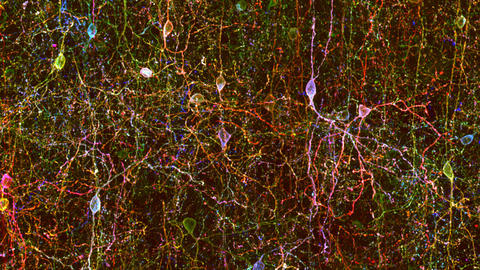 colorful confocal microscope image of neurons