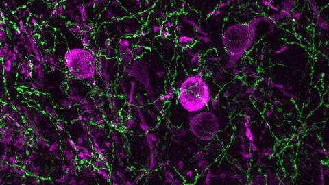 stained axons and cells