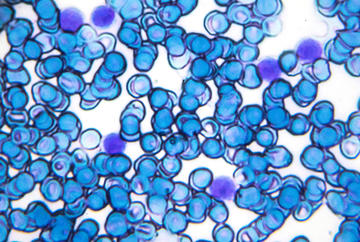 bbs cells