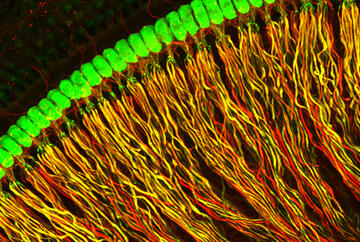 neuron